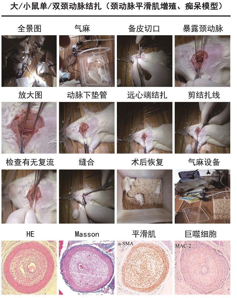 頸動脈平滑肌增殖 、癡呆模型 